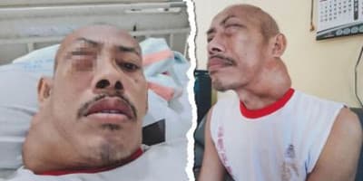 Kanker Ganas Rusak Wajah Buruh Tani